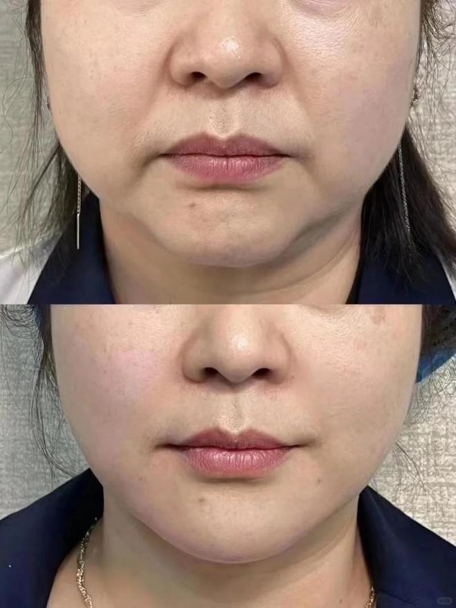 皱紧致效果好的牌子推荐双11建议收藏CQ9电子app抗皱用什么产品好？祛(图5)